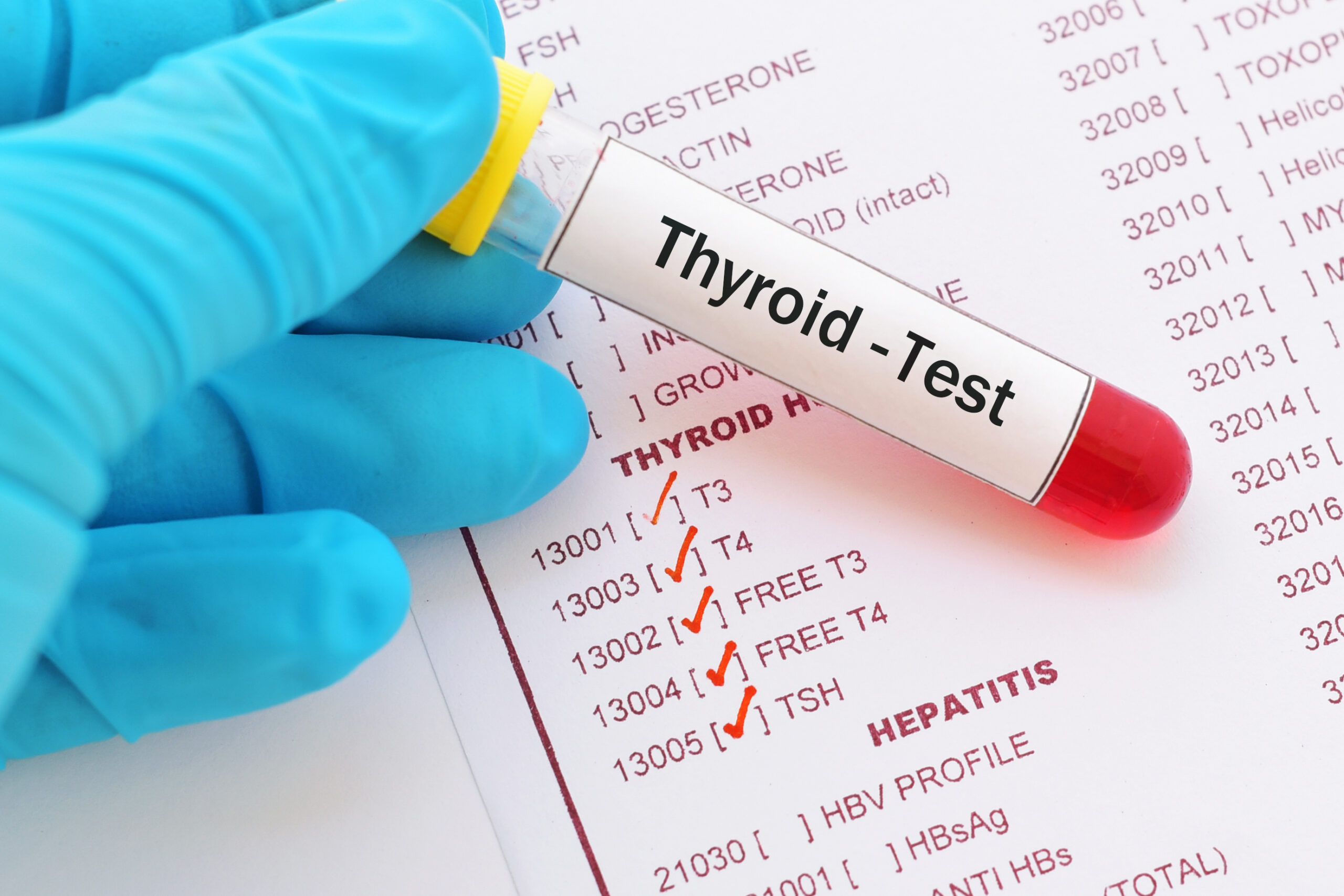 Thyroid Issues