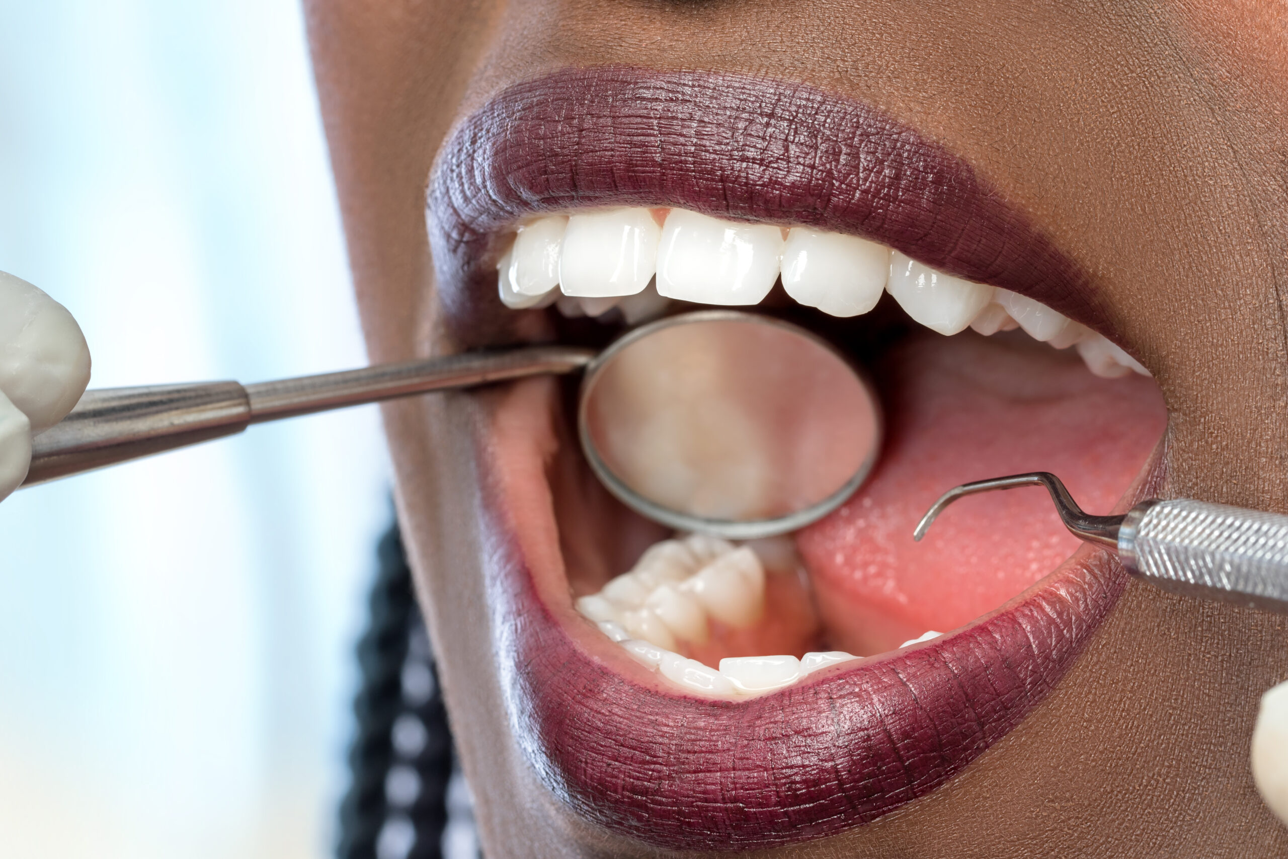 Woman at dentist