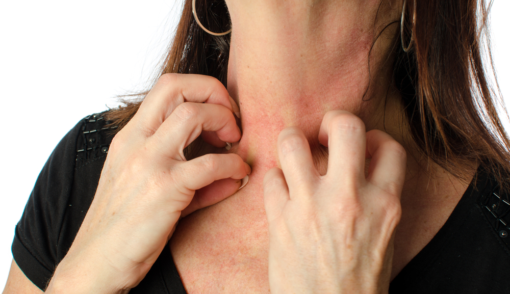Itchy during menopause