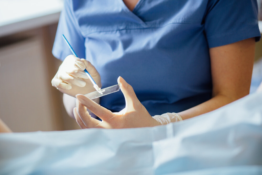 Cervical-Smears.-How-often